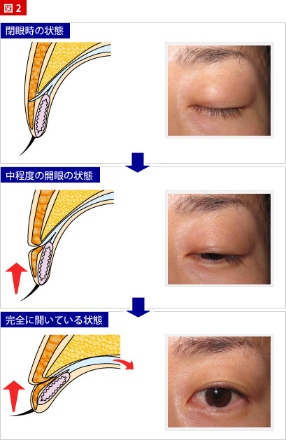 二重まぶた 粉瘤 脂肪腫 わきが治療やレーザー脱毛なら 日本橋形成外科 皮フ科 美容外科