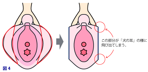 しょう いん しん 痛い